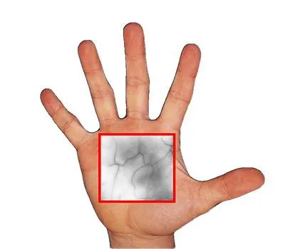 Vein pattern in a hand illuminated for palm vein scanning